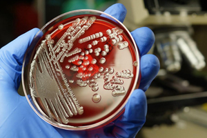 Чем опасны бактерии